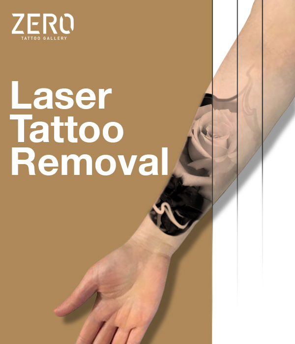 InkAway Laser Tattoo Removal in Chadds Ford & King of Prussia